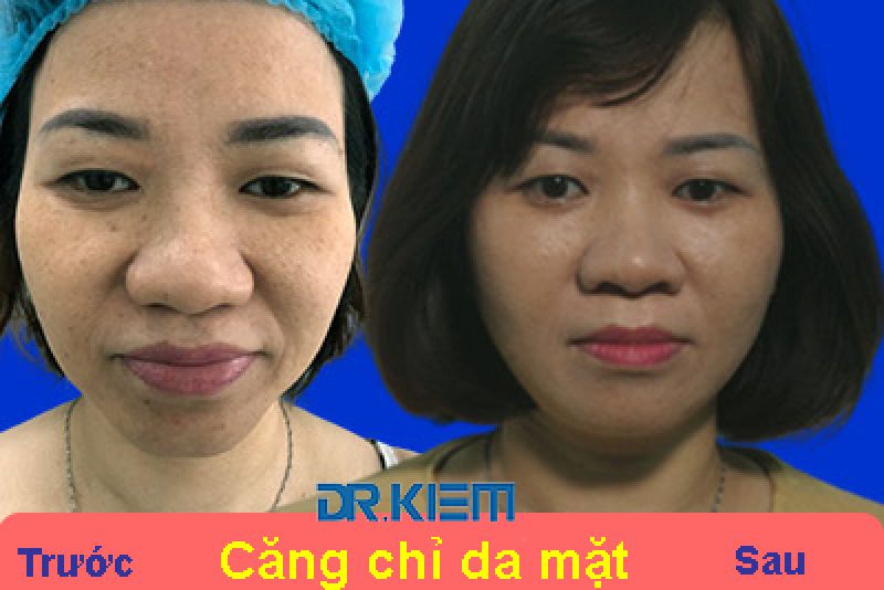 Chiến lược chống lão hóa da