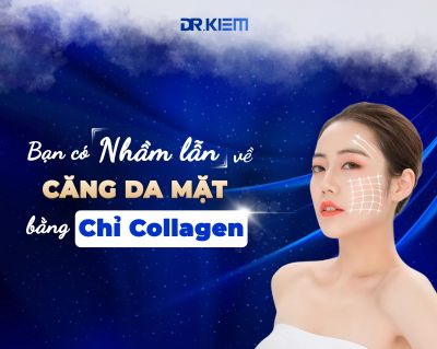 Bạn có đang nhầm lẫn về căng da mặt bằng chỉ Collagen