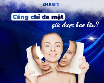 Căng chỉ da mặt giữ được bao lâu và có bị tái lại không?